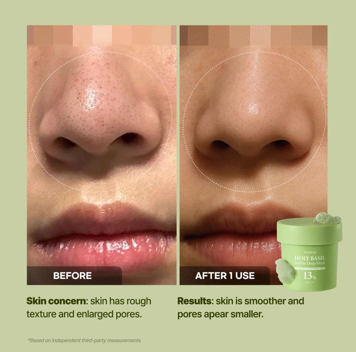 Clogged Pores? Gone.